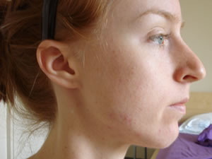 movable lump in cheek by jaw